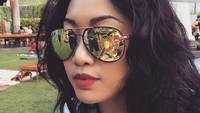 Ia mengaku melakukan treatment isi filler dan tanam benang. (Dok. Instagram/_widikidiw_)