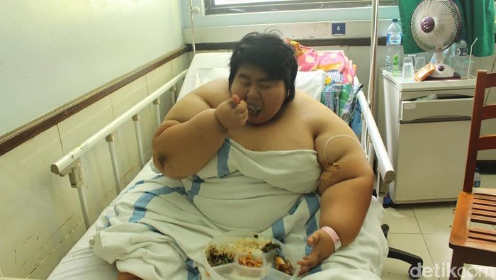 Yunita Remaja Berbobot 125 Kg Mengeluh Nafasnya Ngos-ngosan, Tim Dokter Lakukan Pemeriksaan