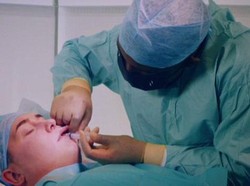 Viral Tren Pria Suntik Filler Bibir Diam-diam di Malam Hari, Tuai Pro Kontra