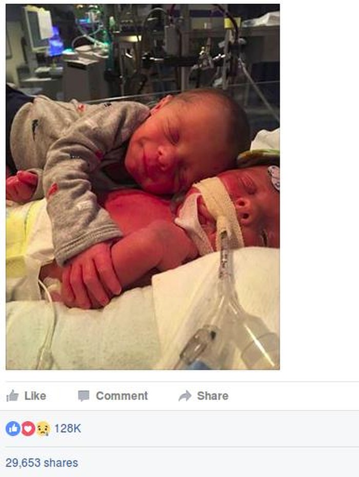 Menyentuh! Foto Bayi Kembar Memeluk Saudaranya yang Sakit