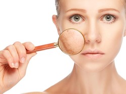 Serupa Tapi Tak Sama, Ini Perbedaan Kulit Kering dan Dehidrasi