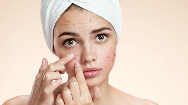 Jerawat Selalu Muncul Lagi? Perbanyak Konsumsi 7 Makanan Alami Ini