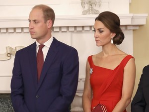 Seperti Pangeran William, Makin Banyak Millennial Mengalami Kebotakan Dini