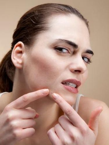 Terobsesi Pencet Jerawat dan Komedo? Hati-hati, Bisa Jadi Gangguan Mental