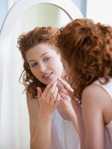 Terobsesi Pencet Jerawat dan Komedo? Hati-hati, Bisa Jadi Gangguan Mental