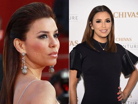 7 Selebriti yang Menutupi Jerawat dengan Makeup