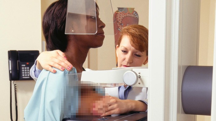 Ada Radiasi, Mammografi dan Rontgen Dada Juga Bisa Picu Kanker?