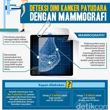 Belajar dari Pengalaman Yana Zein yang Berjuang Lawan Kanker Payudara