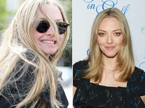 7 Selebriti yang Menutupi Jerawat dengan Makeup