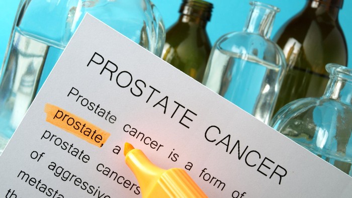 ilustrasi kanker prostat