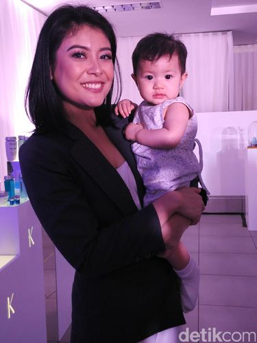  Sigi Wimala Alami Kerontokan Parah Setelah Melahirkan 