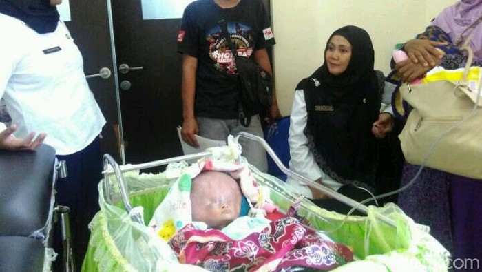 Kesedihan Pasutri asal Trenggalek Anaknya Menderita Hydrocephalus