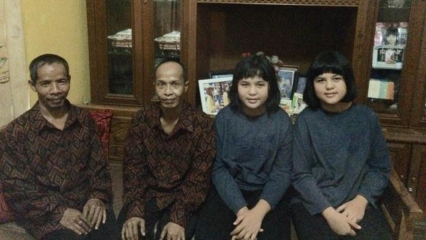 Ini Si Kembar Indentik dari Kampung Kembar, Bagaimana Membedakannya?