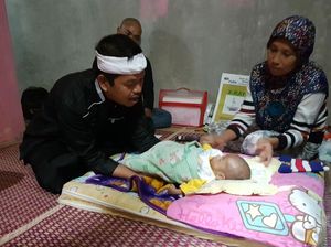 Bayi Rizki di Cianjur Menderita Penyakit Langka