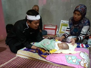 Bayi Rizki di Cianjur Menderita Penyakit Langka