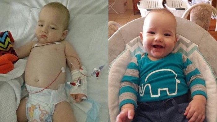 Bayi Ini Diserang Tiga Virus Sekaligus, Diduga karena Duduk di Troli