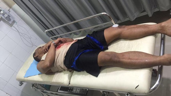 5 Napi Rutan Batam Berusaha Kabur dengan Lompati Tembok