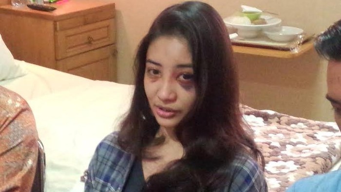 Kondisi Membaik, Saori Tinggalkan Rumah Sakit Sore Ini