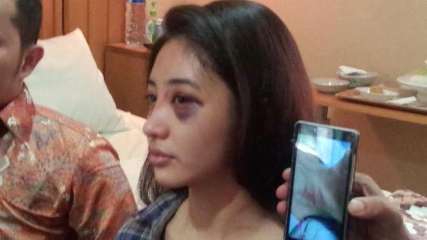 Saori masih merasakan sedikit sakit di hidungnya.