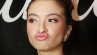 Pose duck face khas Raline. Pool/Gus Mun/detikFoto.