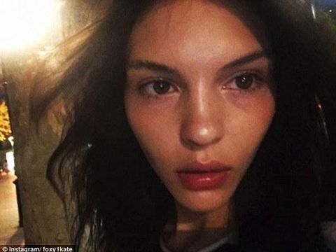 Foto: Kecantikan Kate, Model Rusia 'Kembaran' Kendall Jenner