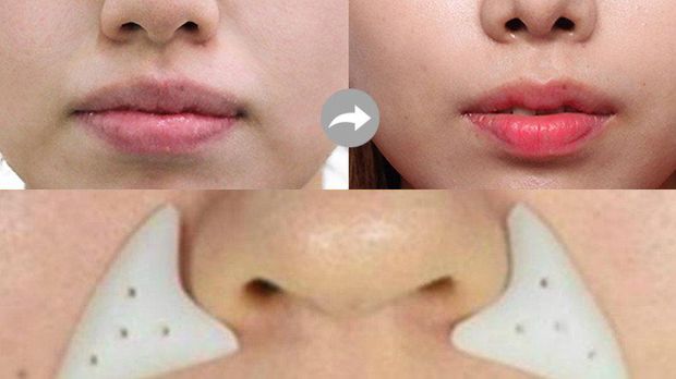 10 Prosedur Kecantikan yang Aneh dan Tak Biasa di Korea Selatan