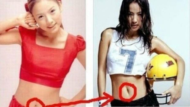 10 Prosedur Kecantikan yang Aneh dan Tak Biasa di Korea Selatan