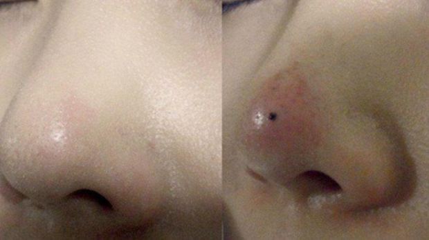 10 Prosedur Kecantikan yang Aneh dan Tak Biasa di Korea Selatan