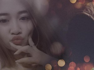 Intan Novita Belum Mau Bicara, 2 Pria Penyiram Air Keras Masih Jadi Misteri