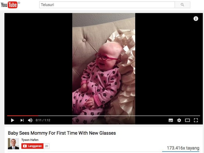 Cute! Video Bayi 3 Bulan yang Bisa Lihat Ibunya Setelah Pakai Kacamata Khusus