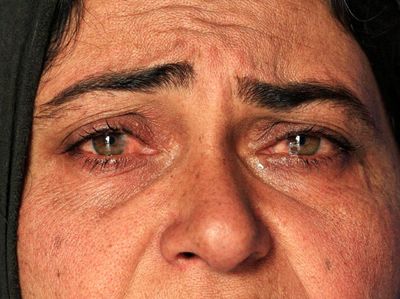 Potret Kesedihan Pengungsi di Mosul