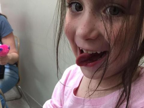 Menyentuh! Foto Bocah yang Bulu Matanya Tinggal 1 Helai Akibat Efek Kemoterapi