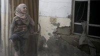Gadis tersebut mengangkat kaki kanannya yang terluka. REUTERS/Bassam Khabieh.