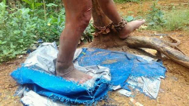 Toirun yang Dirantai 15 Tahun di Bawah Pohon Dibebaskan Dinsos Jatim