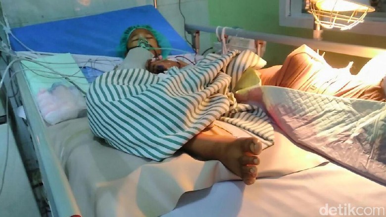 Ini Jawaban Rumah Sakit dr Saiful Anwar Soal Kaki Setyo yang Membusuk Ini Jawaban Rumah Sakit dr Saiful Anwar Soal Kaki Setyo yang Membusuk
