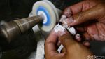 Kembalikan Percaya Diri Dengan Mata Palsu