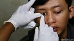 Kembalikan Percaya Diri Dengan Mata Palsu