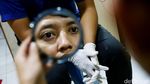 Kembalikan Percaya Diri Dengan Mata Palsu