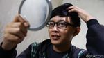 Kembalikan Percaya Diri Dengan Mata Palsu
