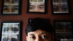 Kembalikan Percaya Diri Dengan Mata Palsu
