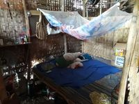 Melihat Perjuangan Balita Melawan Hidrosefalus di Gubug Reyotnya
