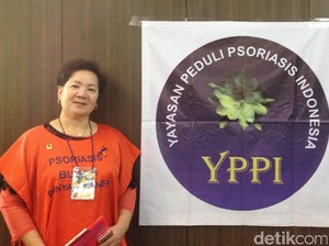 Kisah Ellen, Berhasil Sembuh dari Psoriasis Berkat Terapkan Gaya Hidup Sehat