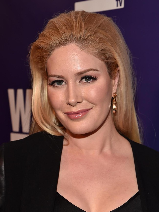 Setelah operasi plastik yang drastis, penampilan Heidi memang banyak berubah. Hidungnya lebih mancung, tubuhnya lebih kurus namun dengan dada yang seksi.  Foto: dok. Getty Images