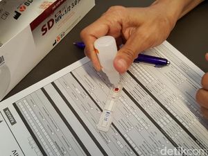 Bos Salon Pemeran Seks Gangbang Ketahuan HIV, Tes di Sini Gratis Lho!