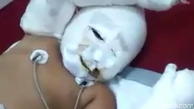 Kisah Haru Bocah Bom Samarinda: Nyanyi Lagu Gereja dan Mimpi Jadi Polisi