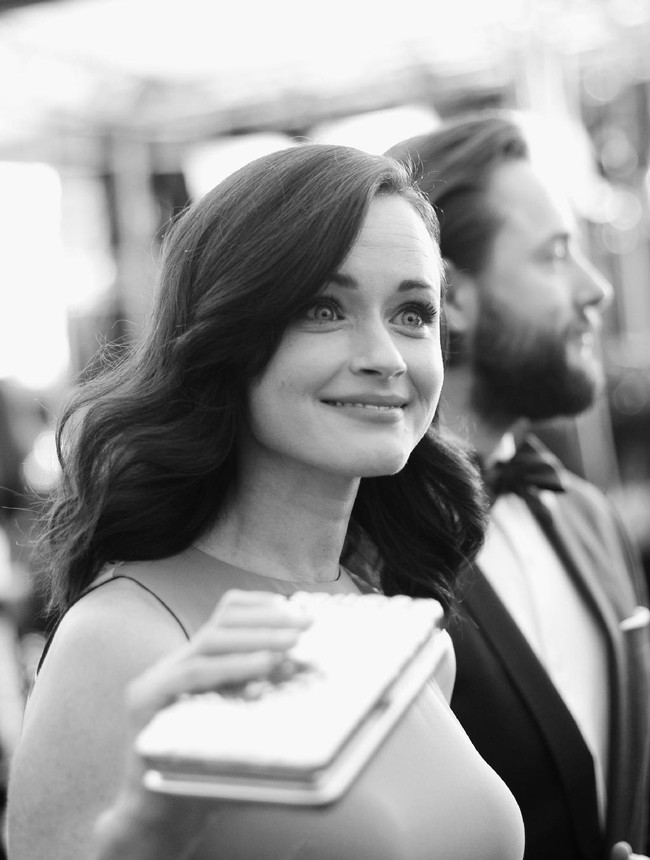 Agar lebih optimal, Brigitte juga memadukannya dengan teknologi terapi sinar mereh dan Environ DF Machine. (Foto: Alberto E. Rodriguez/Getty Images)