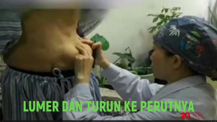 Tragis! Pakai Injeksi Ilegal, Payudara Malah Pindah ke Perut