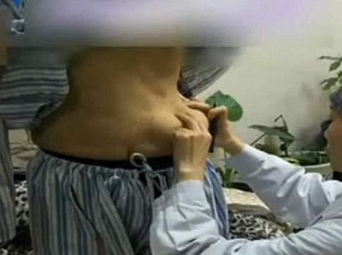 <i>Shock!</i> Payudara Wanita Ini Melorot ke Perut 