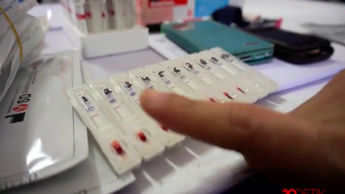 Ilustrasi tes HIV (Foto: 20detik) Ilustrasi tes HIV (Foto: 20detik)