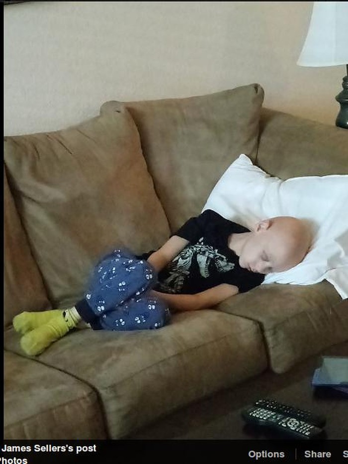 Foto Anak dengan Kanker Langka Setelah Jalani Kemoterapi Ini Bikin Terenyuh